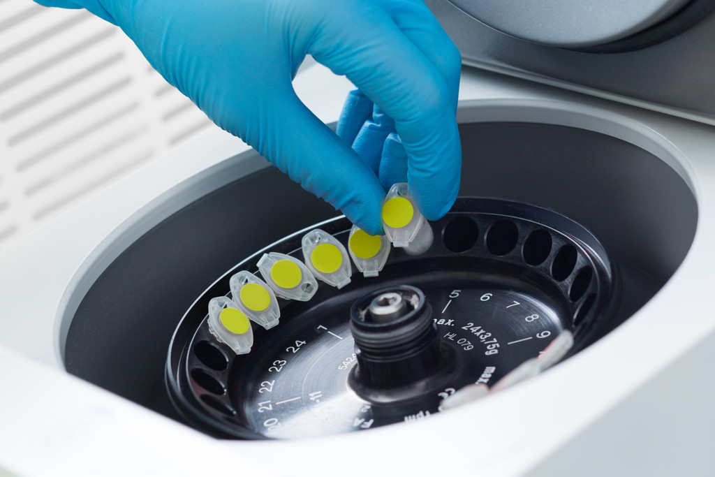 Gloved hand placing sample tubes into a laboratory centrifuge,